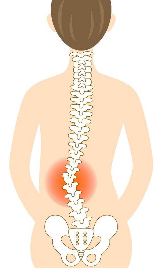 腰椎ヘルニアの主な原因は腰椎（腰の骨）の歪みが原因です。